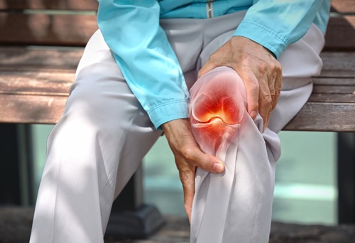 Homeopathic treatment for Arthritis and autoimmune joint inflammation