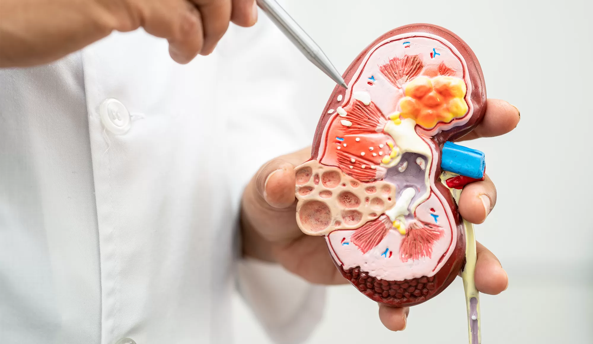 Kidney Stone and Urinary Tract Treatment in Gwalior