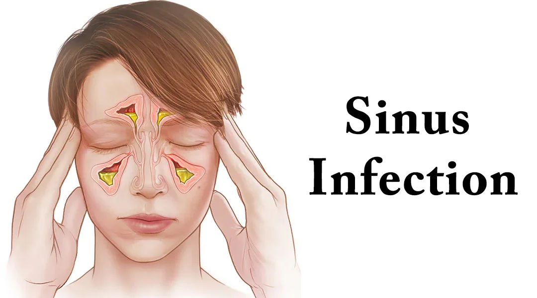 Sinus and Respiratory Infection Treatment in Gwalior